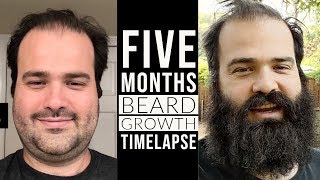 Beard Growth Timelapse 5 Months 160 Days [upl. by Leupold]