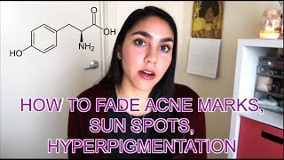 How to Fade Acne Marks Sun Spots Hyperpigmentation  Skin Lightening Agents  KAYA EMPIRE [upl. by Eneryc629]