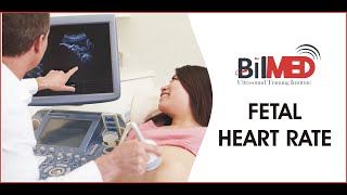 Fetal Heart Rate  Vlogs  BilMed USG Institute [upl. by Acirretahs]