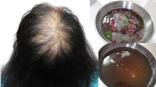 DIY Hibiscus Hair Mask for Extreme Hair Growth  Promote Hair Growth [upl. by Schurman]