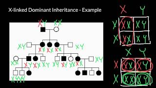 XLinked Dominant Genetic Disorder Example [upl. by Lias576]