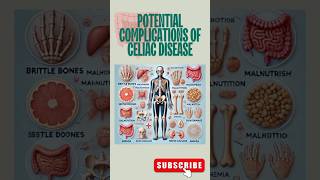 Complications of Celiac Disease What You Need to Know shortsfeed celiacdisease autoimmunedisorder [upl. by Janice75]