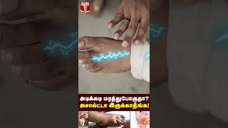 கால் மரத்து போவதன் காரணம் இதுதான்  உடனே கவனிவுங்கள்  Reason for leg numbness  Leg pain [upl. by Nicolau91]