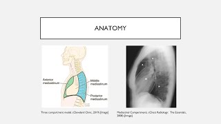 Mediastinal Masses [upl. by Rehpotsirh]