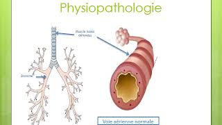 4 Asthme bronchique  Quatrième Année Médecine [upl. by Nwahsirhc]