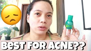 BEST FOR ACNE MAXIPEEL NO 1 First Impression  Demo [upl. by Borden]