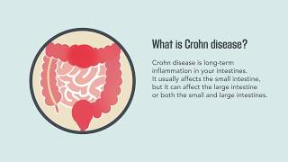 Crohn Disease Signs Symptoms Causes and Treatment  Merck Manual Consumer Version [upl. by Culliton]