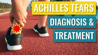 Achilles Tendon Tears  Diagnosis and Treatment of Complete Ruptures [upl. by Ppik]