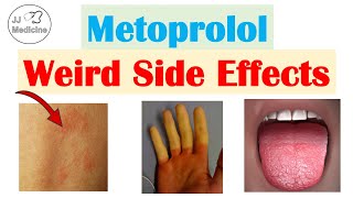 Metoprolol amp Beta Blockers Weird Side Effects Skin Gastrointestinal Psychological [upl. by Muncey]