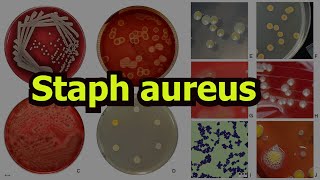 Staphylococcus aureus [upl. by Leiria]