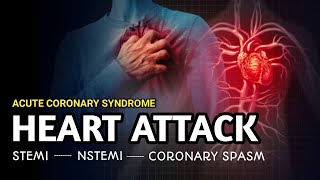 Types of Heart Attack  STEMI NSTEMI Unstable angina  Acute Coronary Syndrome [upl. by Llorrad413]