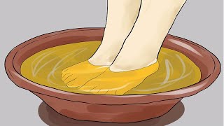 5 Remedios Caseros Para Hongos En Los Pies O Pie De Atleta [upl. by Marciano150]