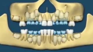 MANTRA TO REGROW TEETH [upl. by Lashond362]