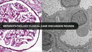 20230221 Nephropathology Clinical Case Discussion Rounds [upl. by Melas]