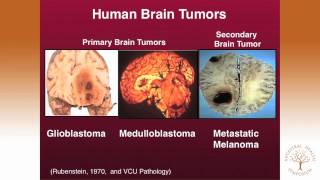 Thomas Seyfried PhD — Targeting Energy Metabolism in Brain Cancer [upl. by Yromem613]