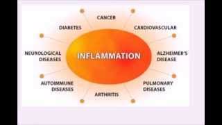 Leading Causes of Inflammation and Digestive Health Issues [upl. by Ynaffit]