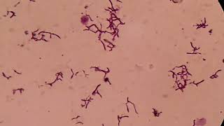 Branching Gram positive Rods Microscopy at various magnifications [upl. by Steffin]