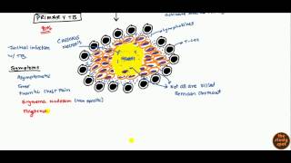 Tuberculosis for USMLE Step 1 and USMLE Step 2 [upl. by Geraint162]