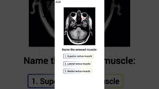 👁️ Anatomy Quiz Extraocular muscle [upl. by Yknip]