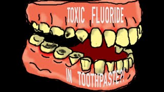 TOXIC Fluoride Present In Our Toothpastes And Water  Why Are Dentists Obsessed With it [upl. by Yruam]