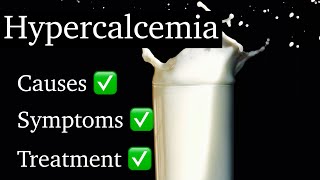 Hypercalcemia  Hypercalcemia Causes Symptoms amp Treatment [upl. by Sanalda]