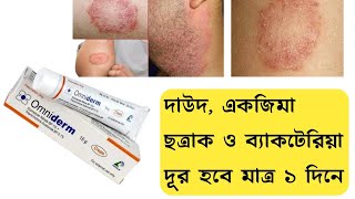 Omniderm Cream এর কাজ কি  দাউদ একজিমা চুলকানি ছত্রাক ও ব্যাকটেরিয়া দূর করার ভালো ক্রিম [upl. by Esau]