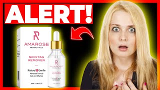 Amarose Skin Tag Remover – BEWARE – Amarose Skin Tag Remover Reviews  Amarose  Amarose Reviews [upl. by Ollopa]