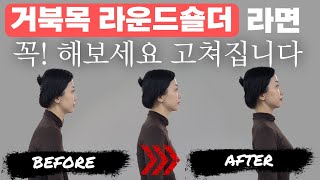 거북목 라운드숄더 방치하면 큰병 됩니다 3단계 스트레칭으로 완벽한 자세교정 [upl. by Eisle]