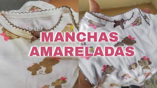 Como tirar MANCHAS da roupa de BEBÊ  MANCHAS AMARELADAS [upl. by Marilin]