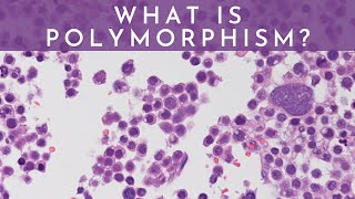 What is Polymorphism  Pathology mini tutorial [upl. by Albina]