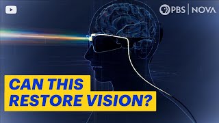 How Brain Implants Are Simulating Vision for the Blind  NOVA  PBS [upl. by Sari496]