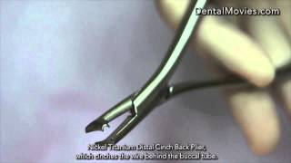 Nickel Titanium Distal Cinch Back Plier [upl. by Aridni]