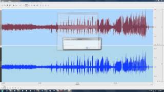 Seizure Detection [upl. by Mccallion]