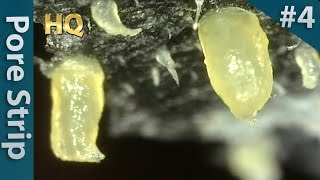 4 Pore Strip Close up  Blackheads Removal  毛穴パックで角栓を除去 [upl. by Florencia]