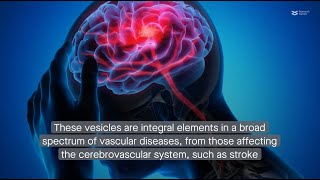 Decoding the roles of extracellular vesicles in vascular diseases [upl. by Llehsor372]