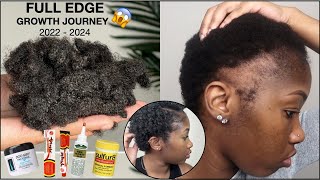 TWO YEAR EDGE GROWTH JOURNEY HOW I GREW MY EDGES  MICRO NEEDLING  DO I STILL USE DOO GRO [upl. by Vowel154]