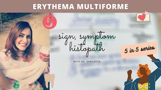 erythema multiforme [upl. by Areht]