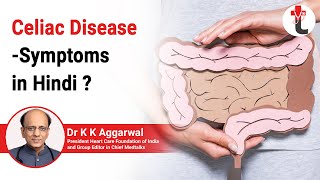 Celiac Disease  Symptoms in Hindi  GlutenFree Diet  Celiac Disease [upl. by Estus385]