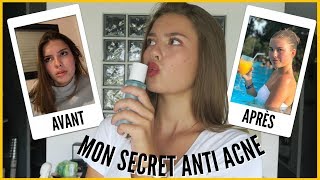 COMMENT JAI VAINCU LACNÉ  Skincare routine [upl. by Anabahs]