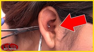 This Conch Piercing Looks BAD Removal [upl. by Hallsy]