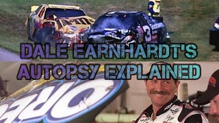 Famous Autopsies Dale Earnhardt [upl. by Violetta]