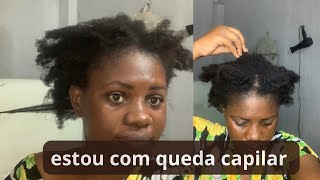 Meu cabelo está caindoatravés da dermatite seborreica [upl. by Akemat]