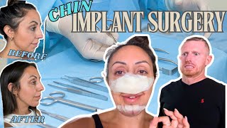 Chin Implant and Deviated Septum Surgery Results My Honest Review [upl. by Ettolrahc38]