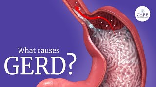 GERD  Gastroesophageal Reflux Disease GERD Causes Symptoms Treatment  Heart Burn  Acid Reflux [upl. by Yeta618]