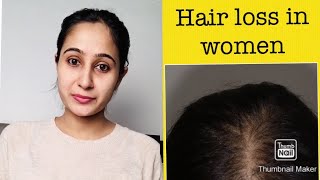 Hair loss in women causes amp treatment  Dermatologist [upl. by Shaum]