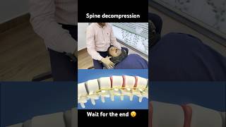 Spine decompression by dr Harish Grover trend ytshort feedshort [upl. by Kamin]