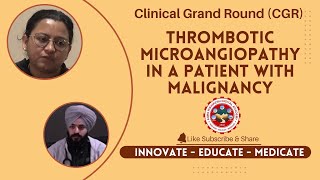 Thrombotic Microangiopathy in A Patient with Malignanncy [upl. by Sitra]