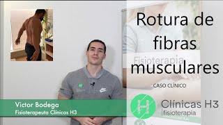 Rotura de fibras musculares 🚶📊 Tratamiento rotura de fibras💪 Caso clínico EXITOSO ✅ [upl. by Bridie]