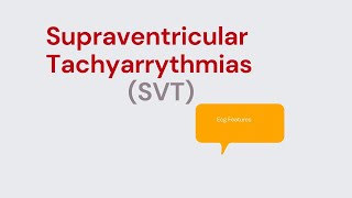 Supraventricular Tachycardia SVT Types and ECG features [upl. by Aneehsit681]