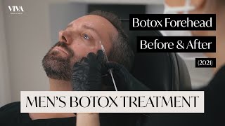 HAIR BOTOX TREATMENT for Dry Damaged Hair haircare hairtips  Dr Rasya Dixit  Doctors Circle [upl. by Benjamen]